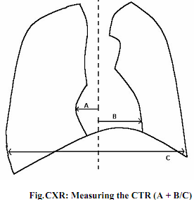 546_What do you know about Cardiothoracic ratio.png
